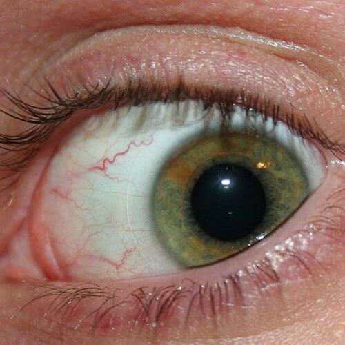 ojo