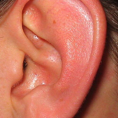oreja