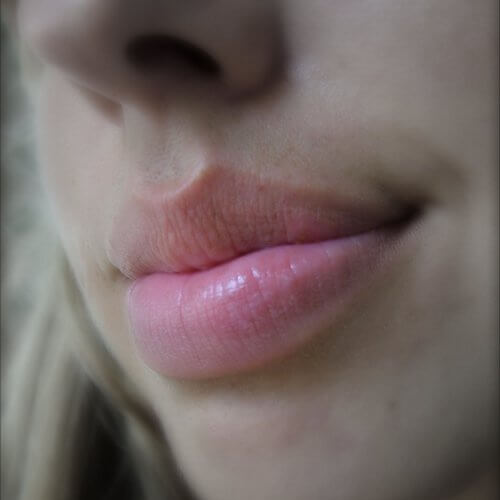 labios