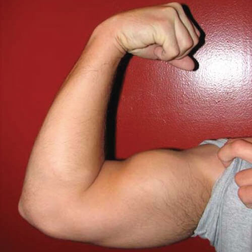 brazo