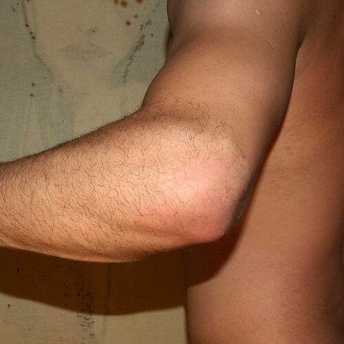 codo