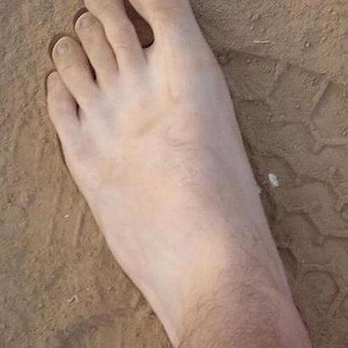 pie